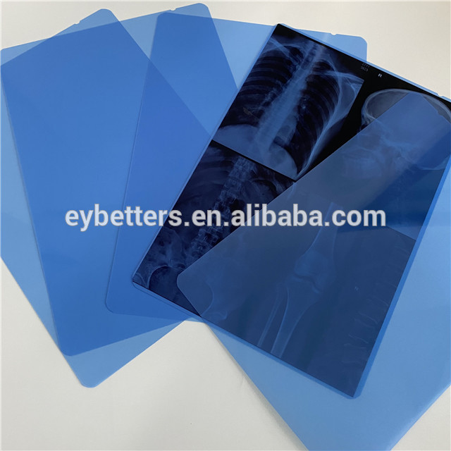 Película de rayos X médica de impresión por inyección de tinta azul PET de 8x10 pulgadas 14x17 pulgadas