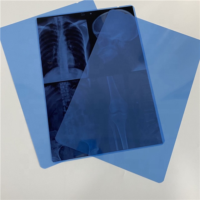 Película de rayos X / Película médica de rayos X / Consumbable médico 11 * 14 pulgadas verde / azul sensible