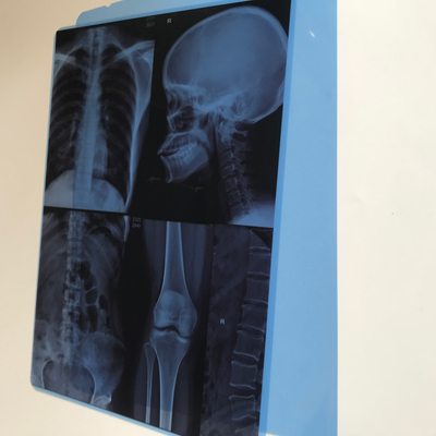 Película azul del ANIMAL DOMÉSTICO de la prenda impermeable de la radiografía médica A4 8 * 10 para imprimir